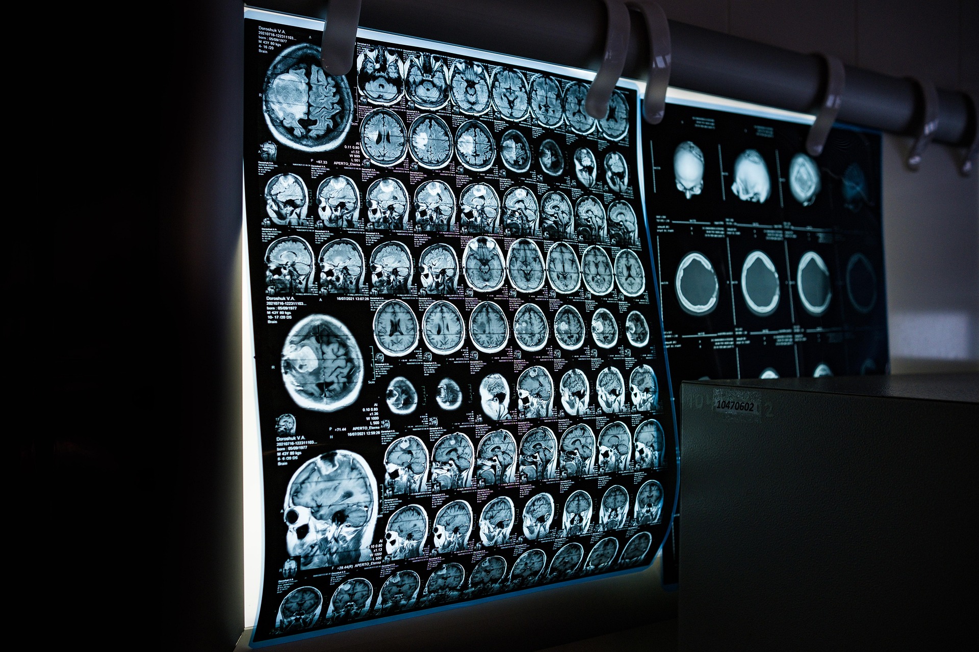 Imagini de diagnostic medical pe un panou luminos